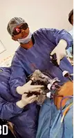 kidney cancer specialist doctor - Dr. Saket Narnoli